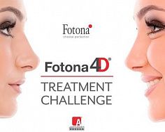 Fotona4D® Treatment Challenge